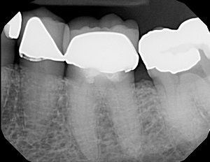 Leer más sobre el artículo Dentaltown publica una retirada de 70 años