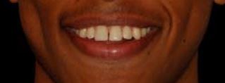 La sonrisa restaurada de Yosef