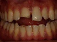 Leer más sobre el artículo Odontología heroica: Cómo Yoseph recuperó la sonrisa