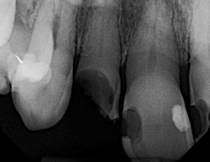 Leer más sobre el artículo Odontología heroica: Salvarle el día a Judy