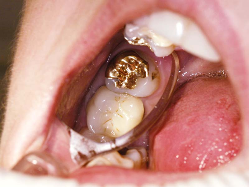 clinical-procedure-flecta-2