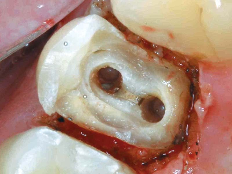 clinical-procedure-spee-dee-1