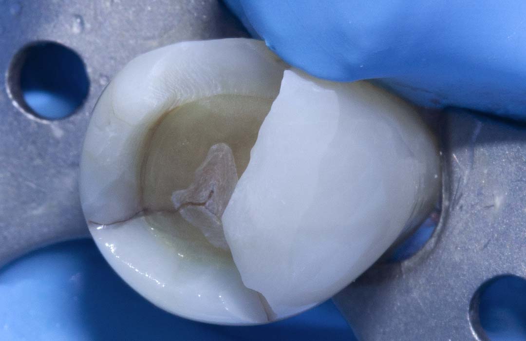 case-1-activa-presto-before