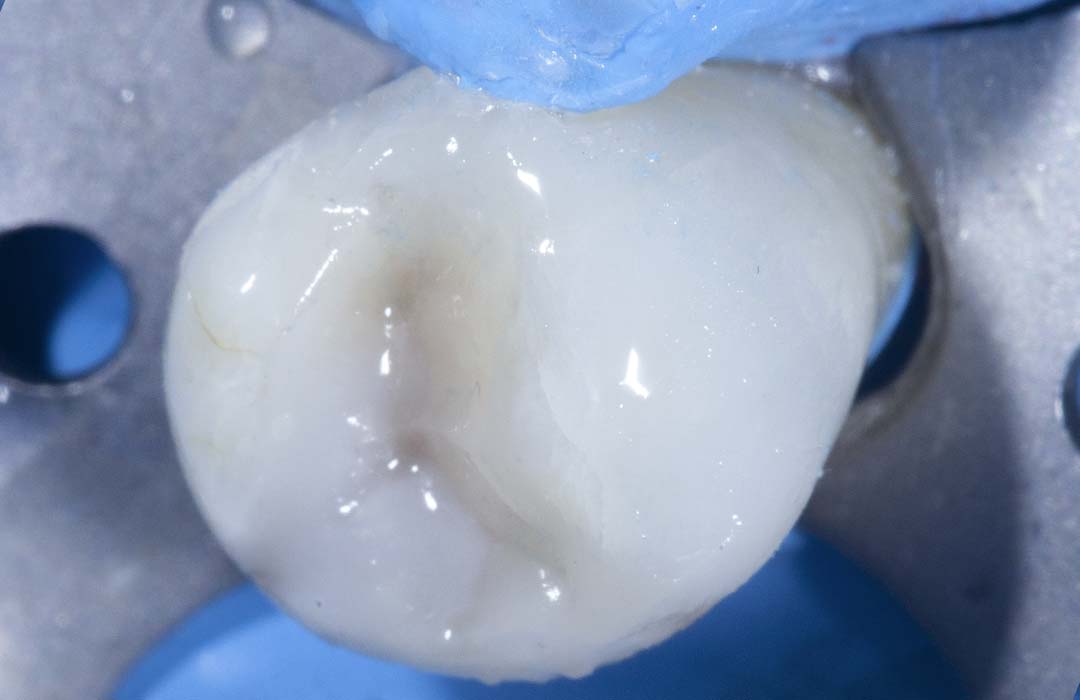 case-2-activa-presto-before