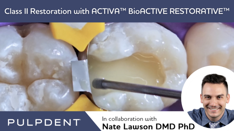 Leer más sobre el artículo Restauración de clase II con ACTIVA™ BioACTIVE-RESTORATIVE™.